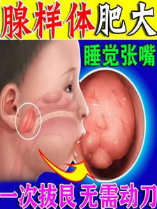 【厂家101%冶好】儿童张嘴呼吸不通气腺样体嘴贴调理腺样体面容矫正