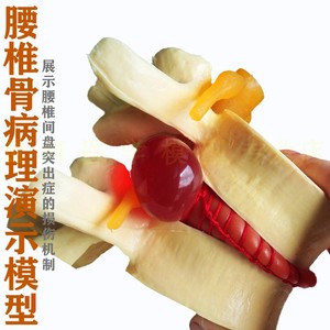 正品人体腰椎间盘脊柱脊椎关节模型 腰椎模型教具